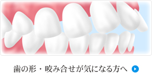 歯の形・咬み合せが気になる方へ