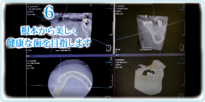 6根本から美しく健康な歯を目指します
